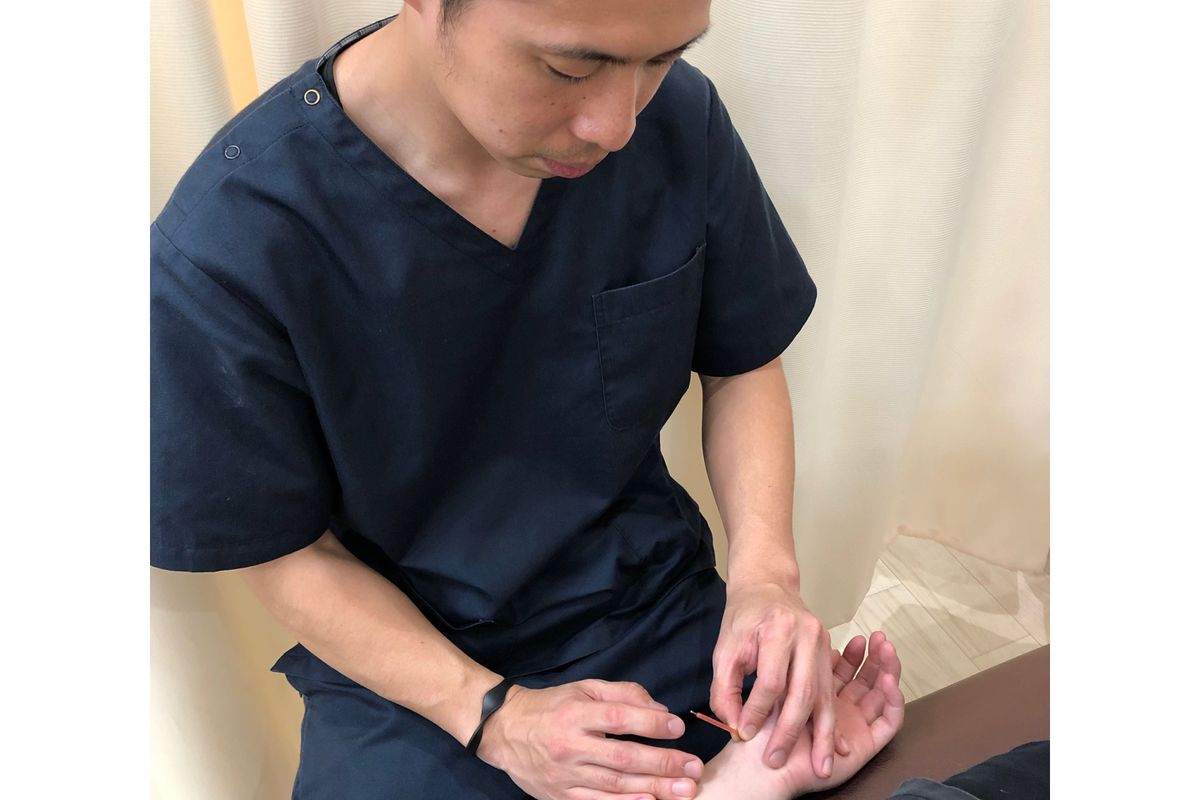 鍼灸 全身